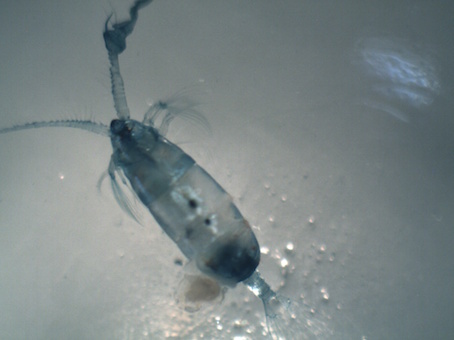 Copepod plankton under the microscope